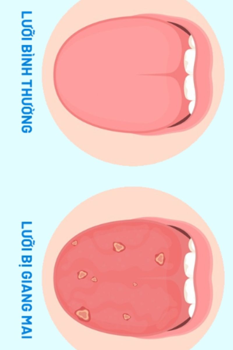 Hình ảnh Giang Mai ở Lưỡi nguy hiểm nhất 7